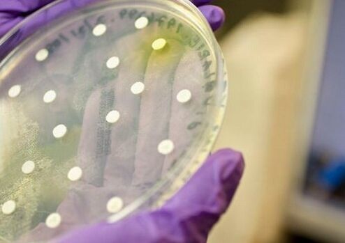 bakteriální kultivace pro diagnostiku prostatitidy